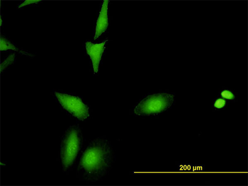 CRADD monoclonal antibody (M01), clone 1F8