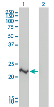 CRADD monoclonal antibody (M01), clone 1F8