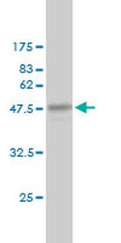 CRADD monoclonal antibody (M01), clone 1F8