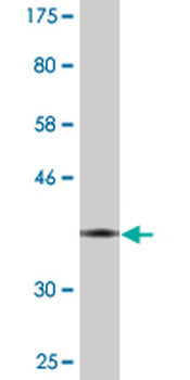 EED monoclonal antibody (M05), clone 3B12