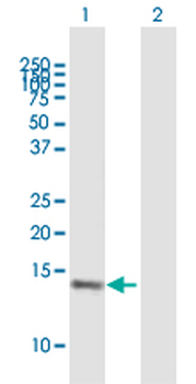 VAMP8 purified MaxPab mouse polyclonal antibody (B01P)