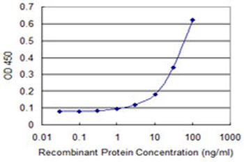 ALDH4A1 monoclonal antibody (M01), clone 1A12-A5