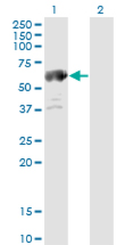 ALDH4A1 monoclonal antibody (M01), clone 1A12-A5