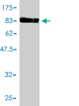 ALDH4A1 monoclonal antibody (M01), clone 1A12-A5