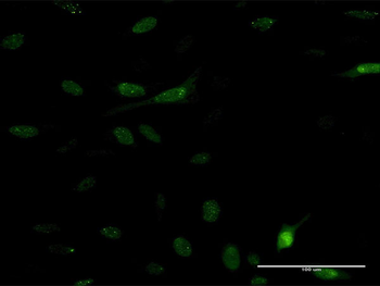 PDE5A monoclonal antibody (M01), clone 9H5