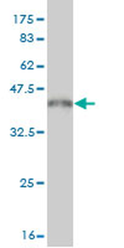 PDE5A monoclonal antibody (M01), clone 9H5
