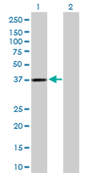 AKR1C3 purified MaxPab rabbit polyclonal antibody (D01P)