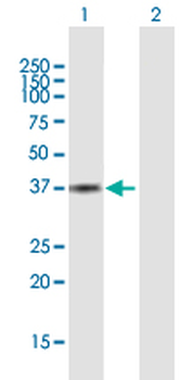 AKR1C3 purified MaxPab mouse polyclonal antibody (B01P)