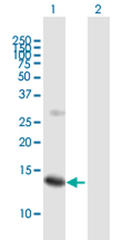 SSNA1 purified MaxPab mouse polyclonal antibody (B01P)