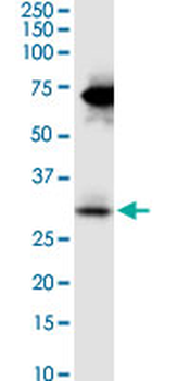 STC2 monoclonal antibody (M08), clone 2B11