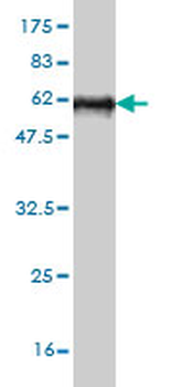 STC2 monoclonal antibody (M08), clone 2B11