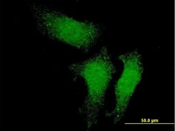 RUVBL1 monoclonal antibody (M01), clone 3G4-1F8