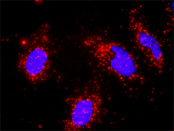 RUVBL1 monoclonal antibody (M01), clone 3G4-1F8