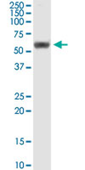 RUVBL1 monoclonal antibody (M01), clone 3G4-1F8