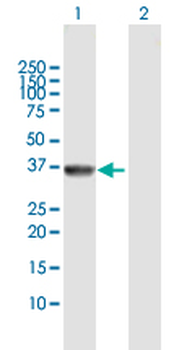 AKR7A2 MaxPab rabbit polyclonal antibody (D01)