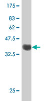 PDXK polyclonal antibody (A01)