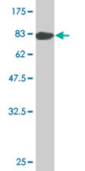 YARS monoclonal antibody (M02), clone 2F3