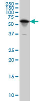 YARS monoclonal antibody (M02), clone 2F3