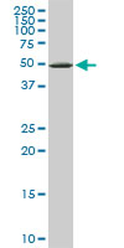 YARS monoclonal antibody (M02), clone 2F3
