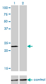 DENR monoclonal antibody (M01), clone 1H3