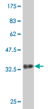 DENR monoclonal antibody (M01), clone 1H3
