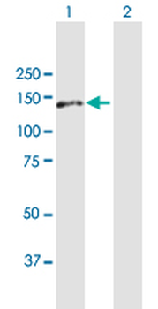AP3B1 purified MaxPab mouse polyclonal antibody (B01P)