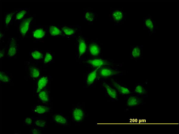 API5 monoclonal antibody (M01), clone 1C2