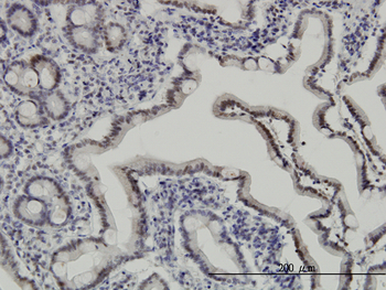 API5 monoclonal antibody (M01), clone 1C2