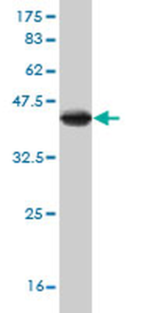 API5 monoclonal antibody (M01), clone 1C2