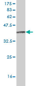ITGA8 monoclonal antibody (M02), clone 2G7