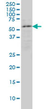 ENC1 monoclonal antibody (M02), clone 3B1