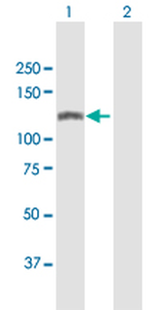 SMARCA5 MaxPab mouse polyclonal antibody (B01)