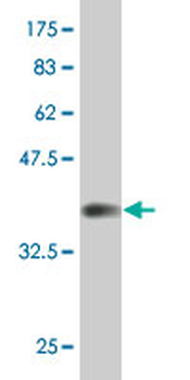 KLF11 monoclonal antibody (M03), clone 10D8