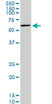 KLF11 monoclonal antibody (M02), clone 10C5