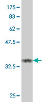KLF11 monoclonal antibody (M02), clone 10C5
