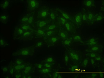 KLF11 monoclonal antibody (M01), clone 8F4