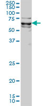 KLF11 monoclonal antibody (M01), clone 8F4