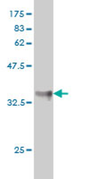 KLF11 monoclonal antibody (M01), clone 8F4