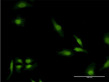 EEA1 monoclonal antibody (M03), clone 2G2