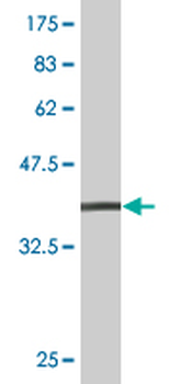 EEA1 monoclonal antibody (M03), clone 2G2