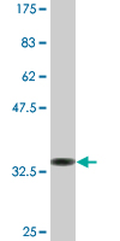 EEA1 monoclonal antibody (M02A), clone 1D4
