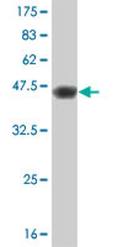 PIP5K1B polyclonal antibody (A01)