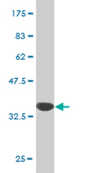 NME5 monoclonal antibody (M04), clone 4F5