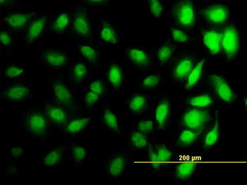 HIST1H3D monoclonal antibody (M01), clone 1D8