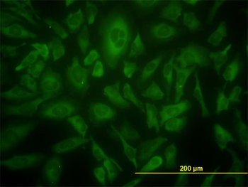 USP9X monoclonal antibody (M01), clone 1C4