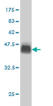 USP9X monoclonal antibody (M01), clone 1C4