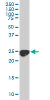 CLPP monoclonal antibody (M01), clone 3E2