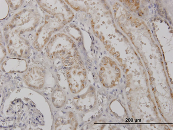 CLPP monoclonal antibody (M01), clone 3E2