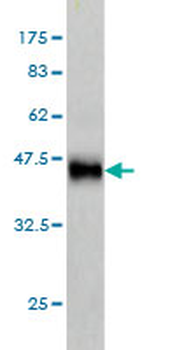 CLPP monoclonal antibody (M01), clone 3E2