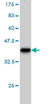 USP5 monoclonal antibody (M01), clone 2C8